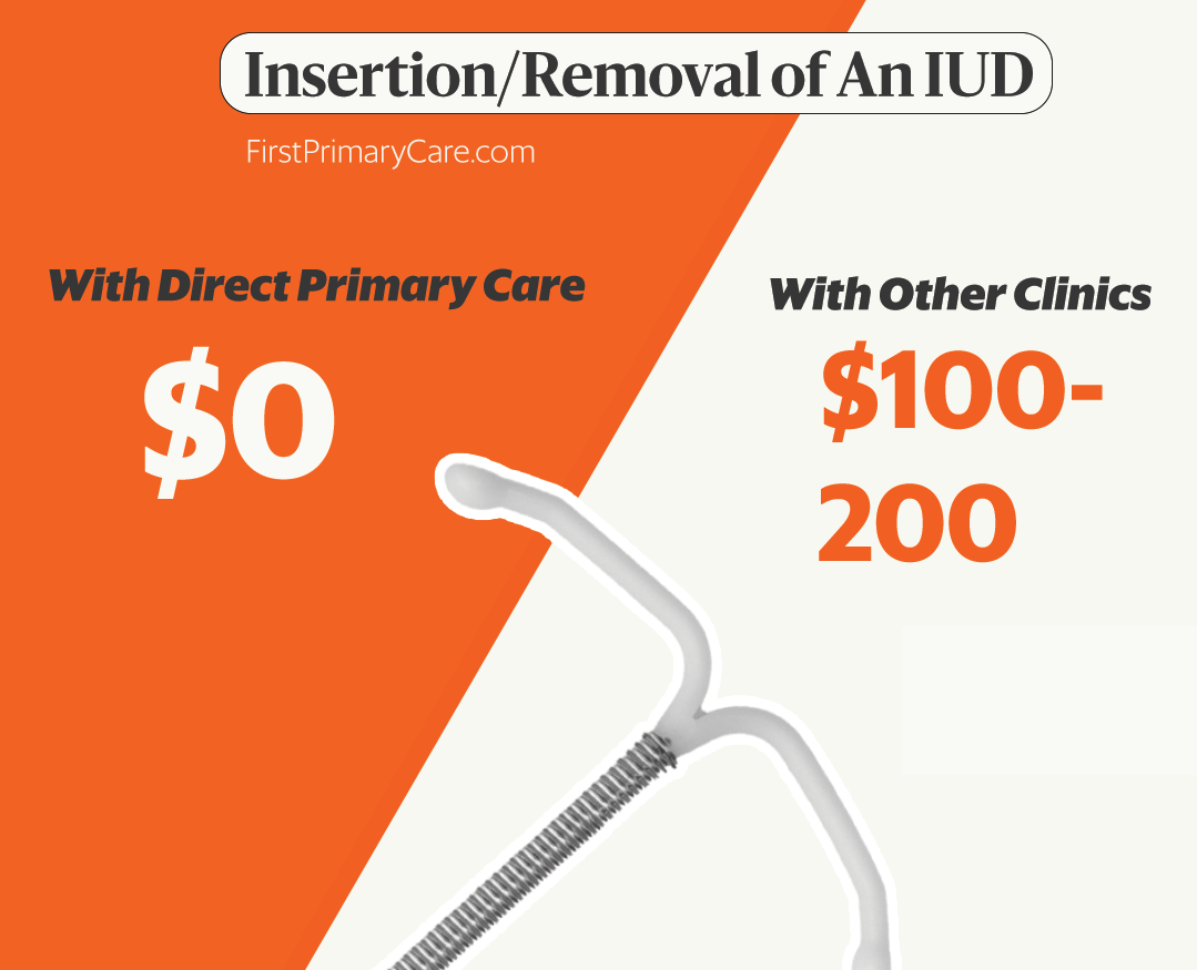 IUDprice